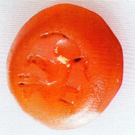 Siegelstein